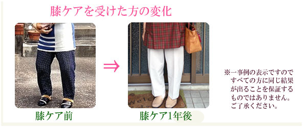 膝ケアを受けた方の変化